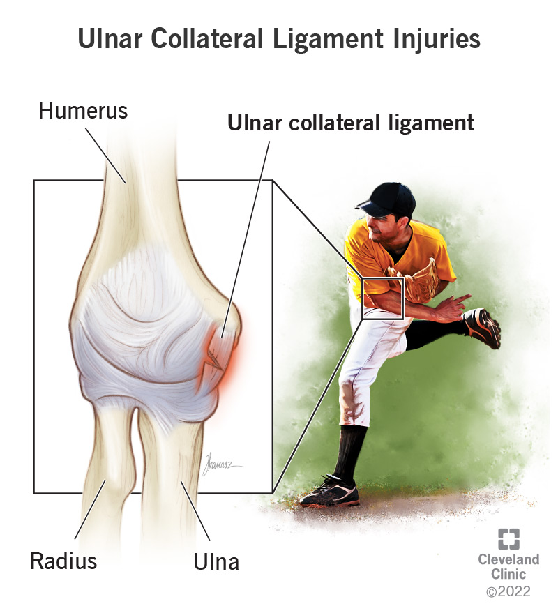 UCL injury and elbow anatomy reference
